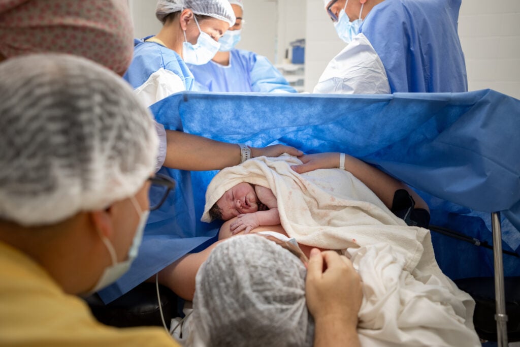 Mother and newborn daughter by cesarean section - Doctors performing a cesarean section in the operating room - Buenos Aires - Argentina